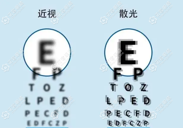 散光眼和近視眼有什么區別？和近視的感覺不一樣，癥狀是..