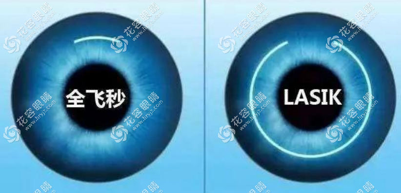 北京近視眼手術價格一覽表2023,800度icl晶體植入參考價3.2萬起