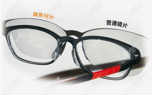 離焦鏡片眼鏡一副多少錢?離焦近視眼鏡價格約1-8k能控制近視