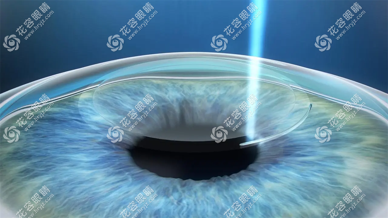 北京協(xié)和眼科醫(yī)院怎么掛號(hào)?協(xié)和眼科可電話/官網(wǎng)掛號(hào)預(yù)約