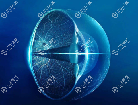 视达佳ok镜为什么这么贵?有透氧系数高，控制视力好等优点