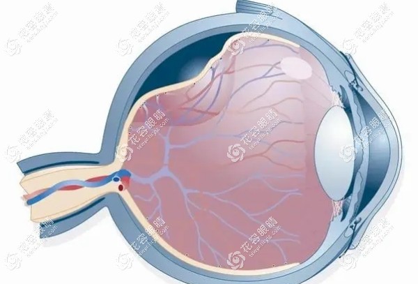 視網膜脫落手術成功幾率和風險高嗎?成功幾率高,手術風險大