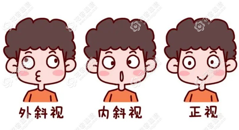 南京眼科劉虎在明基和人民醫(yī)院坐診-斜視手術(shù)好(掛號(hào)費(fèi)300)