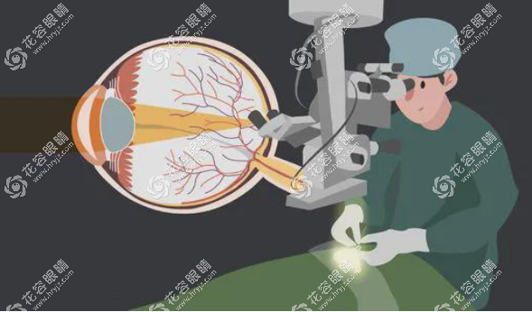 愛爾眼科醫院和華西醫院做近視眼手術哪個好?聰明人這樣選