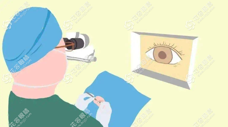 从激光近视手术年龄和度数限制中，30岁能做激光近视手术吗