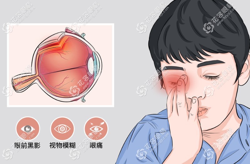 楊培增在重慶附屬第一醫(yī)院眼科,看葡萄膜炎好,附預(yù)約掛號(hào)