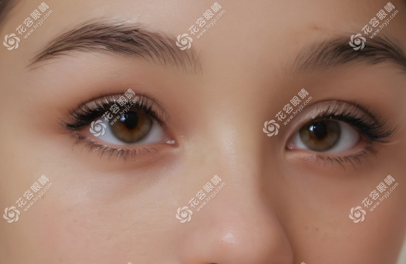 沈陽興齊眼科醫(yī)院是正規(guī)醫(yī)院，和四院不是一家但有合作關(guān)系