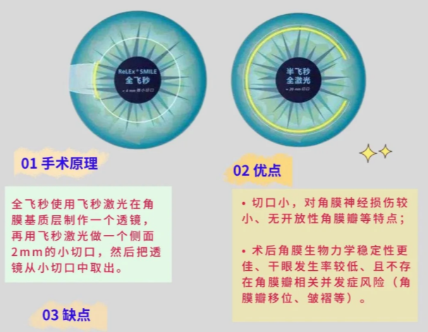 近视矫正手术