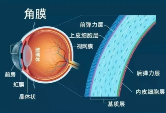 南宁近视矫正手术