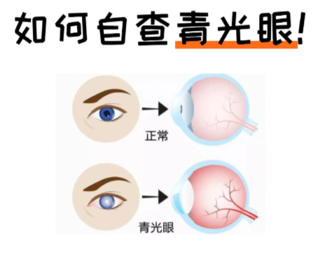 乳山市爱尔眼科医院能做青光眼手术吗