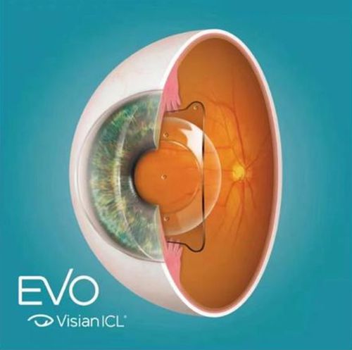 昆明胡敏眼科医生ICL晶体植入3万起