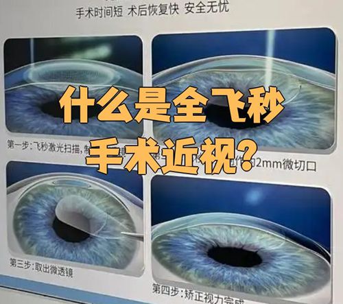 重庆南坪爱尔眼科价格表明细