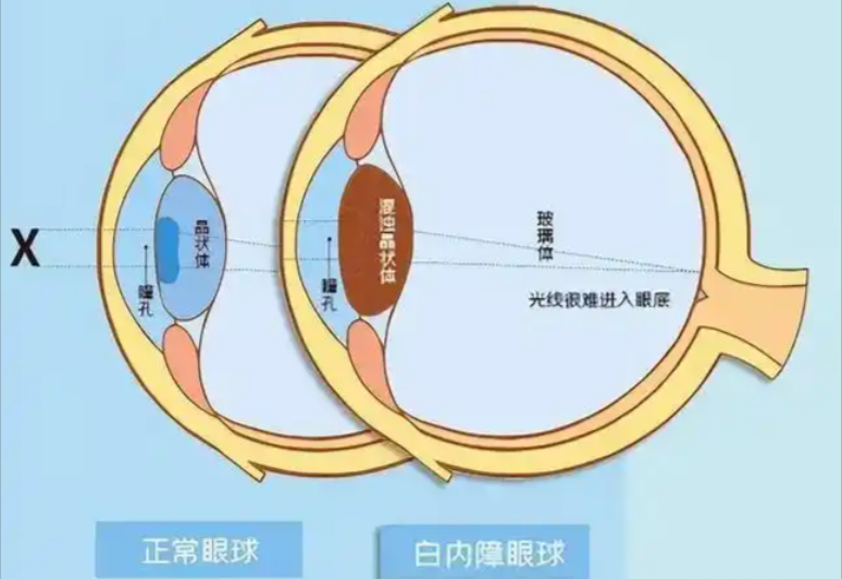 针对60岁及以上老人的政策