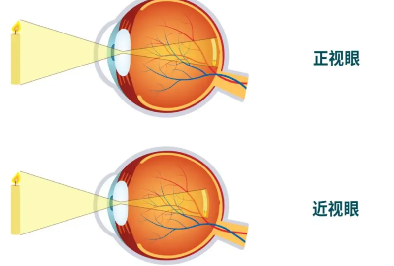 相關(guān)服務(wù)體現(xiàn)對近視重視