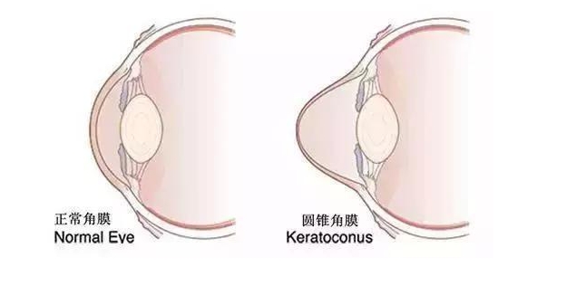 貴港眼科醫(yī)院排名榜出爐 愛眼/愛爾/華廈3家私立院是本地人選得最多的