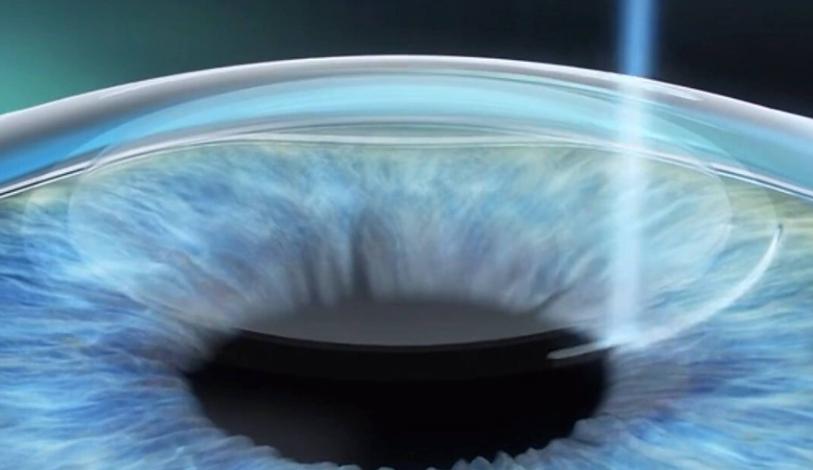 合肥名人眼科醫(yī)院手術(shù)量vs本地機(jī)構(gòu)：量穩(wěn)價(jià)優(yōu)，服務(wù)更貼心