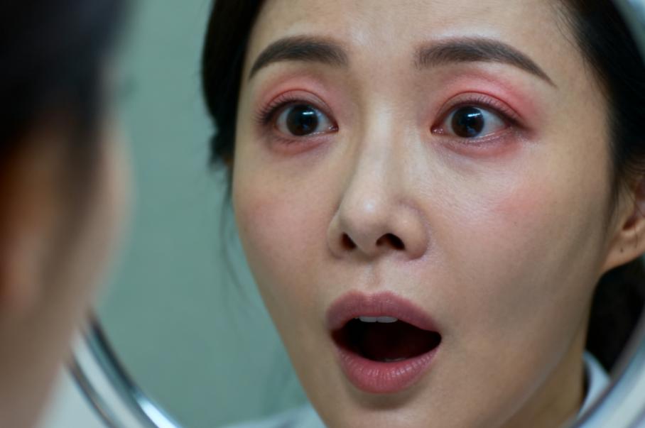 昆明眼袋消融術(shù)選擇建議