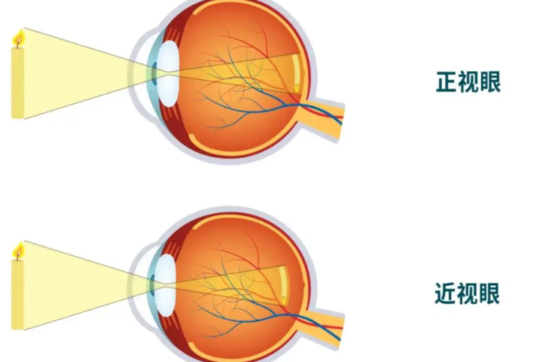 重慶近視手術(shù)醫(yī)生排名榜全新揭曉