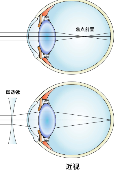 重慶近視手術(shù)醫(yī)生排名榜單詳細(xì)介紹