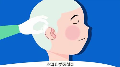 長庚醫(yī)院陳潤茺2025小耳再造手術費用及影響因素