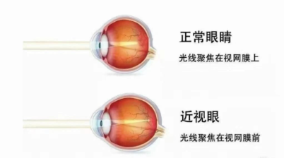 南寧眼科醫(yī)生哪個好？