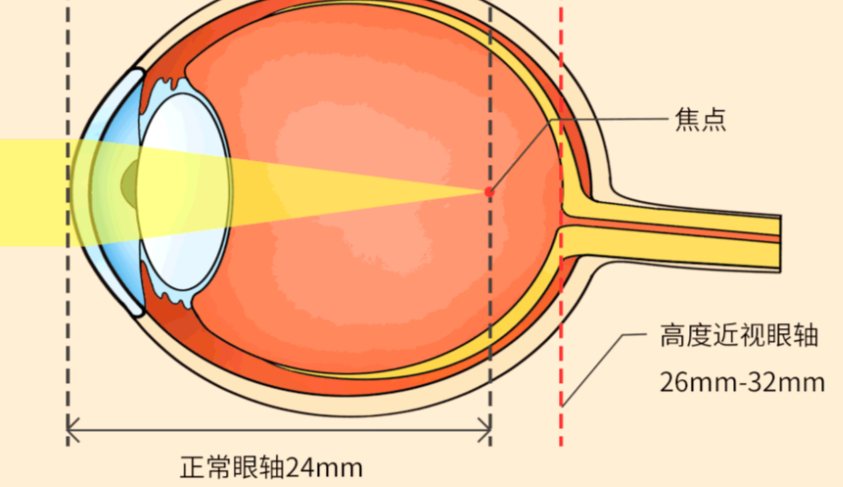 南寧眼科醫(yī)生手術(shù)價格