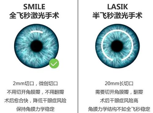 聊城光明眼科激光手術(shù)價(jià)目表真實(shí)匯總：從9800到35000元，按度數(shù)/角膜厚度匹配術(shù)式，價(jià)格透明可查