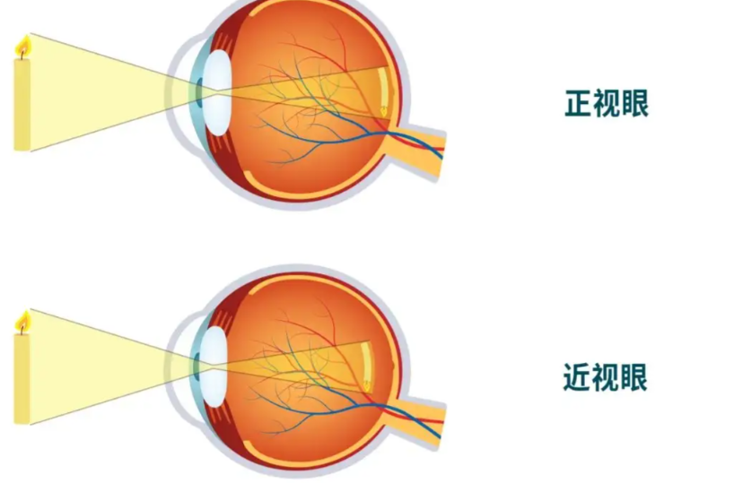 貴陽眼科醫(yī)生哪個好？