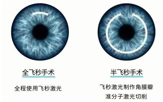 貴陽眼科醫(yī)生哪個(gè)好？李志敏、張唯偉、彭艷麗優(yōu)質(zhì)醫(yī)生大盤點(diǎn)