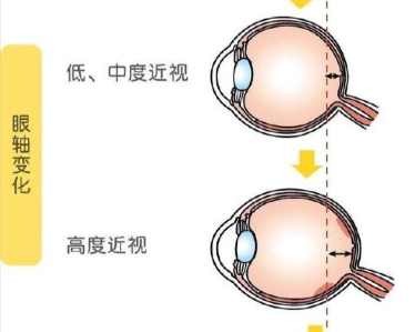 沈陽(yáng)眼科醫(yī)生哪個(gè)好？