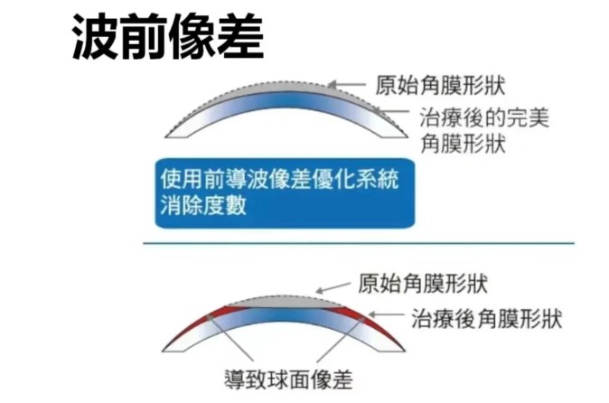 三、按需求場景選：對(duì)應(yīng)術(shù)式更穩(wěn)準(zhǔn)