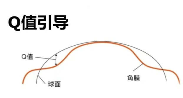 五、真實(shí)實(shí)例：不同場景的選擇參考