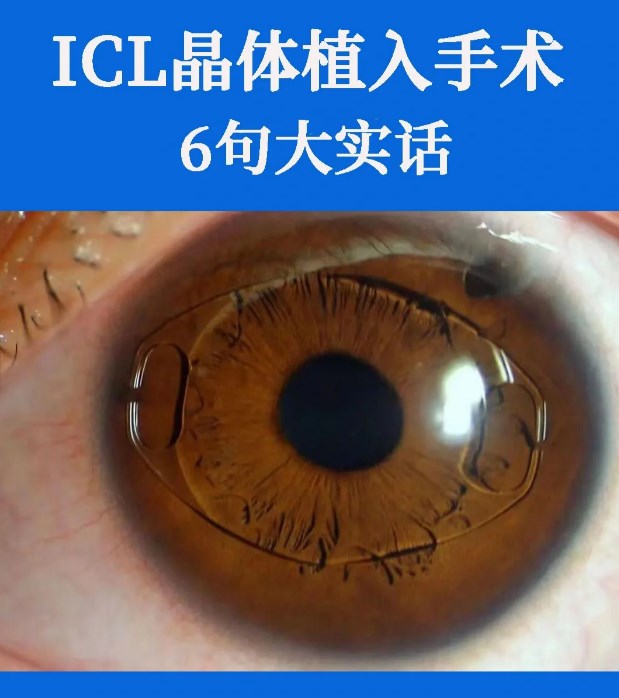 三、梅州愛明眼科配套：鐘院長坐診的診療確保的coffeeteaherbs.com