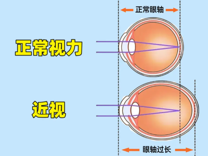 沈阳眼科医院哪家好？