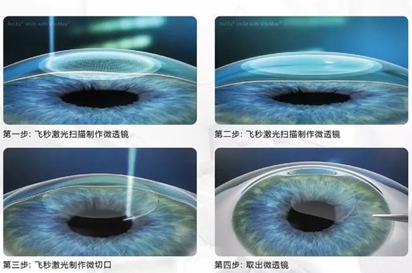 商丘尖峰眼科医院详细地址在哪？梁园区民主西路999号附就诊预约提示