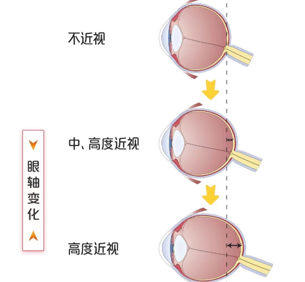 全科预检如何破解三大认知误区？