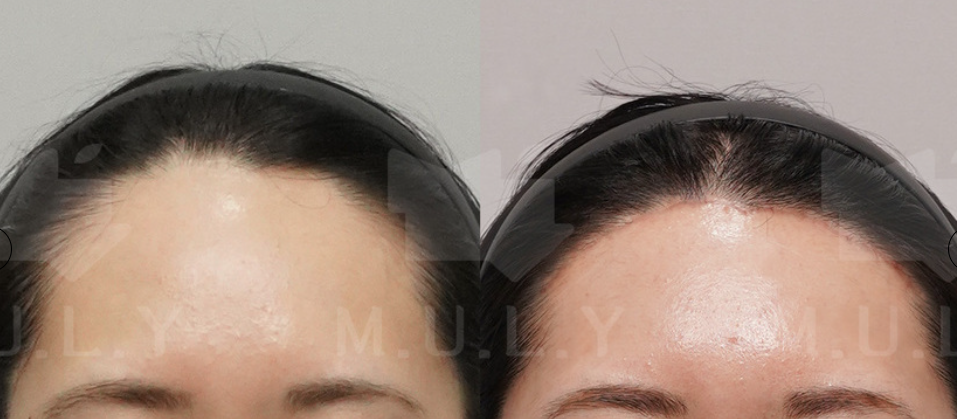 Signature Procedures & 2026 Pricing Guide at Muly