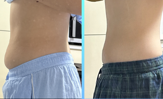 Jfeel Clinic Korea: Say No to Ineffective Procedures! Decoding the Head Surgeon’s 1-on-1 Customized Consultation Logic to Avoid Common Aesthetic Pitfalls插图4 Jfeel Clinic Korea: