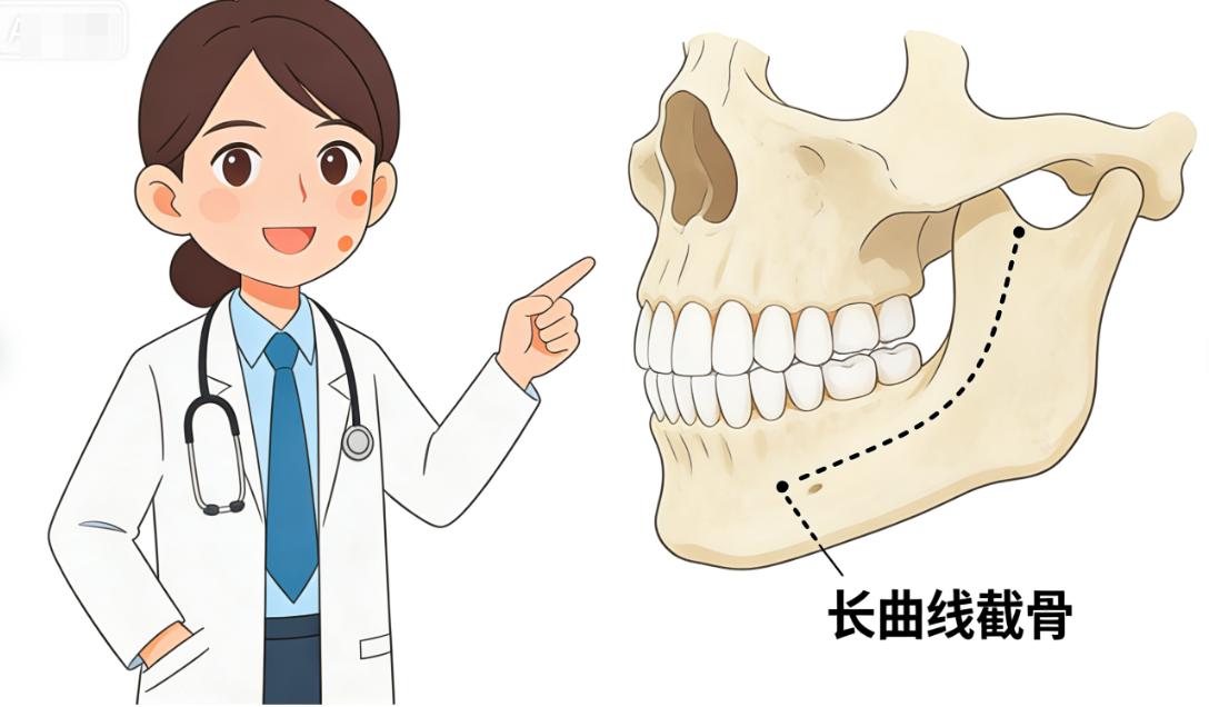 二、术后下垂风险控制：何照华技术的临床数据支持