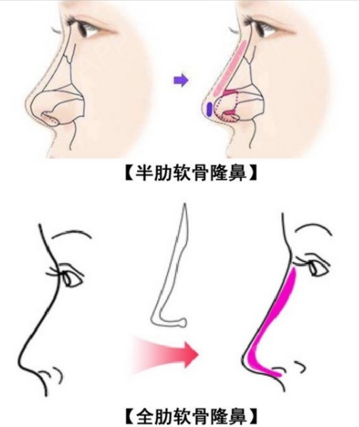 五、如何根据预算选择合适方案