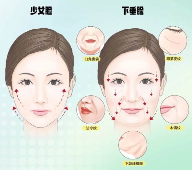 一、冯啸面部微调能维持多久