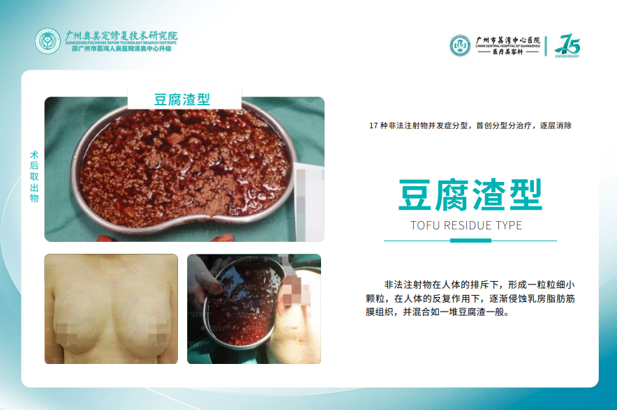 王绍国和黎星怎么选?从手术适应症看医生专长
