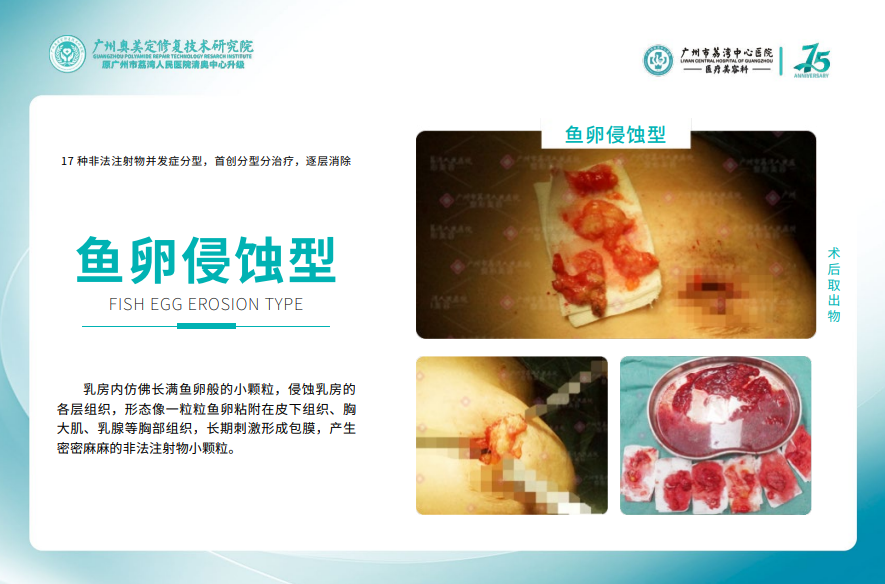 王绍国和黎星怎么选?面诊体验与术后变好对比www.hryjz.com