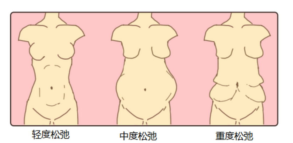 刘宾腹壁整形多少钱？对比崔鑫/李献和收费标准，看名医的技术溢价到底值不值