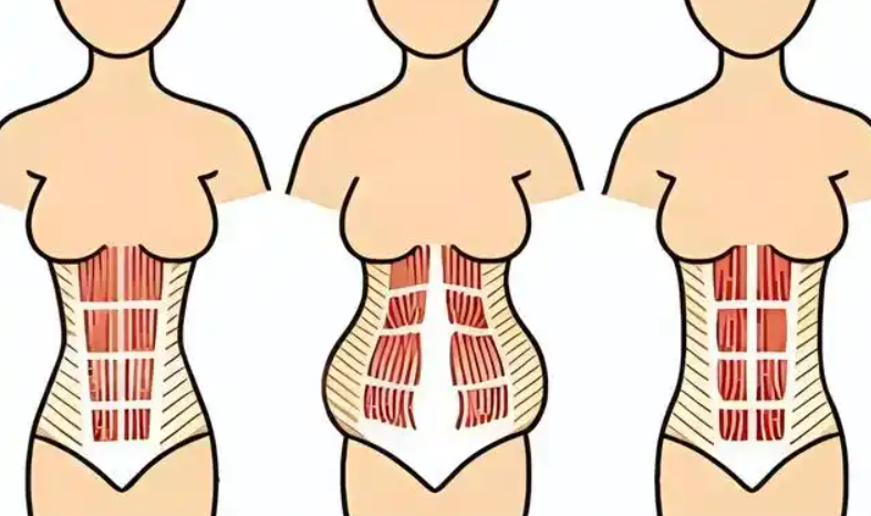 三、关于刘宾腹壁整形,姐妹们较常问的Q&Awww.hryjz.com