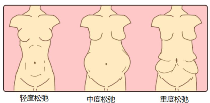 关于崔鑫和刘宾医生，姐妹们常问的几个问题www.hryjz.com