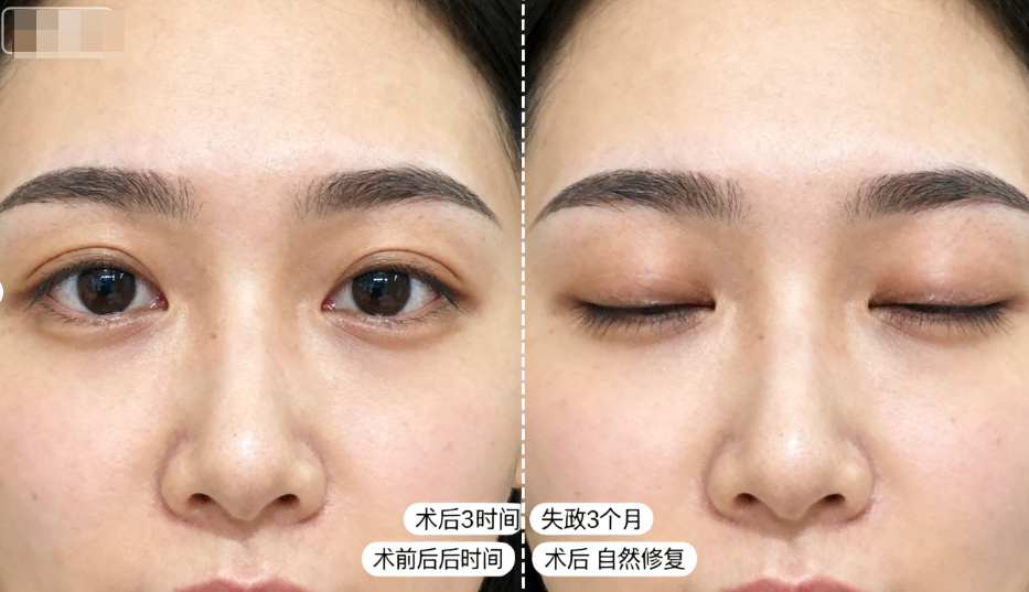 说实话郑小红在哪个机构坐诊？2026年安禾美阁&佳富美高难修复最靠谱！
