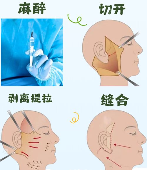 三、核心技术与项目疗效详解