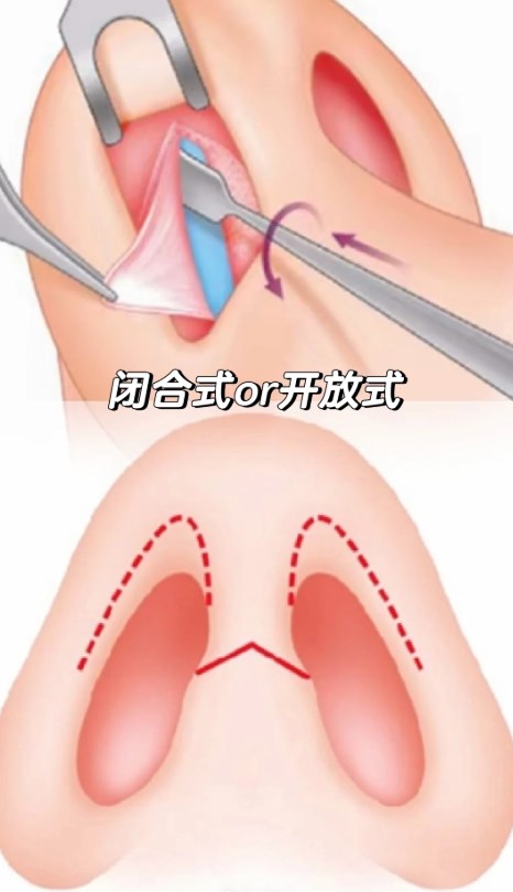 除了隆鼻，深圳宝丽在其他项目上表现如何？