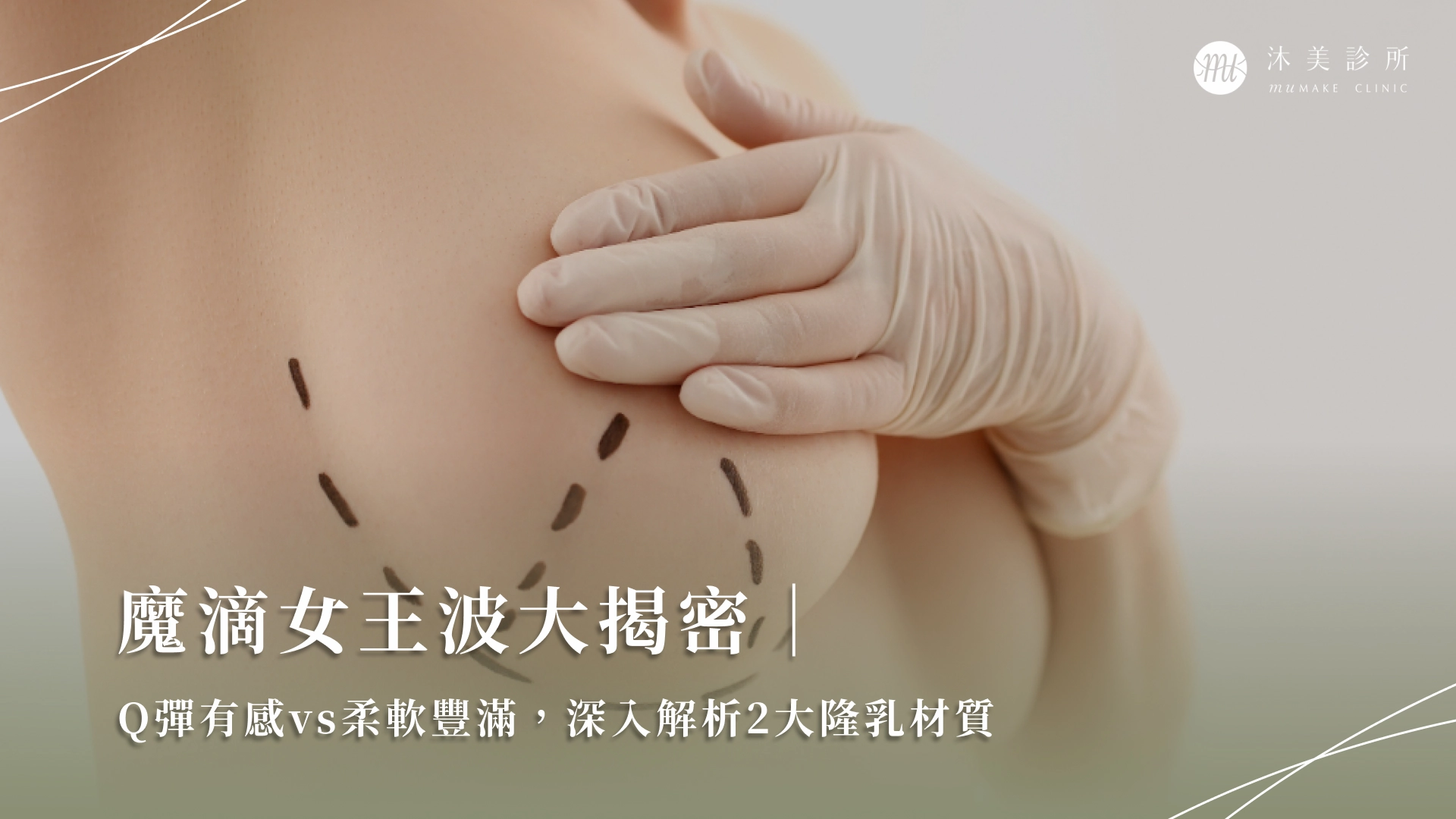 三、南京隆胸手术价格明细与决策要素